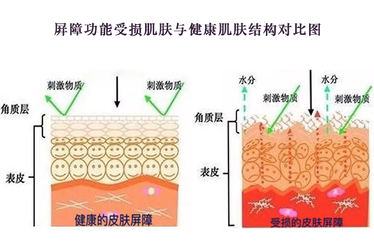 屏障受损与健康肌肤对比图PNG750.png